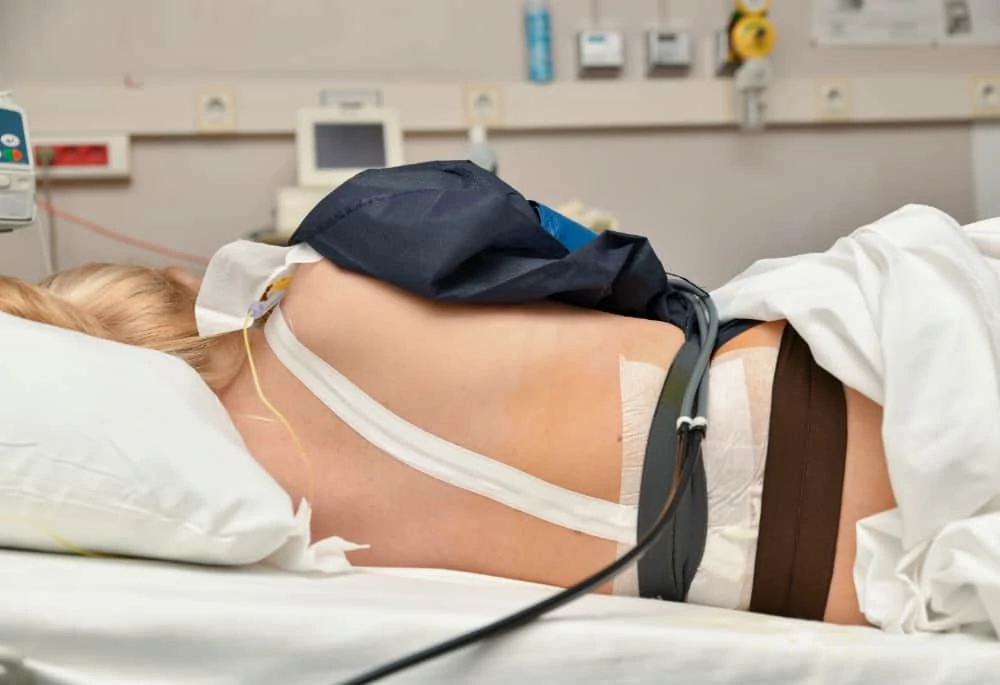 Epidural During Labor